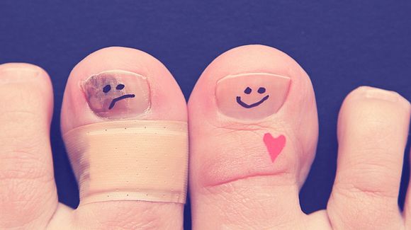 Грибковые инфекции: виды и лечение