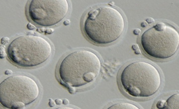 Японцы вырастили печень из стволовых клеток